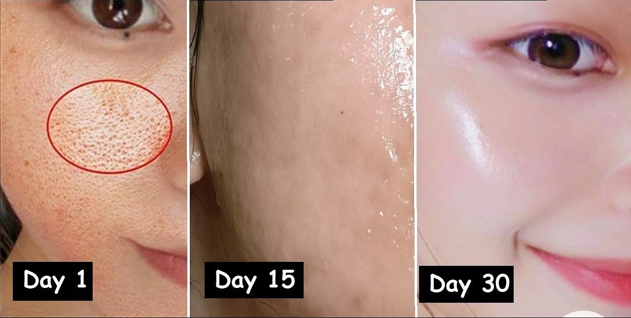 Tips mengecilkan pori-pori wajah untuk kulit halus dan sehat.