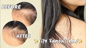 Tips Solusi Mengurangi Kebotakan Rambut Agar Sehat dan Lebat