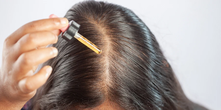 Dampak Penggunaan Minoxidil untuk Pertumbuhan Rambut