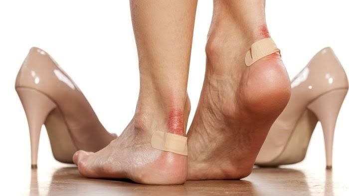Tips Ampuh Agar Tidak Lecet Saat Menggunakan Heels