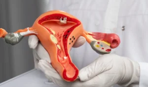 Cara Mencegah Kanker Serviks