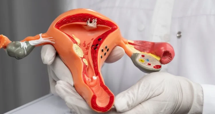 Cara Mencegah Kanker Serviks