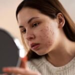 Mengatasi Wajah Bruntusan dengan Tepat dan Aman